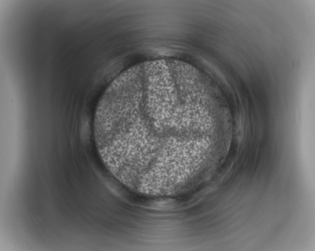 X0000115140410200911241510