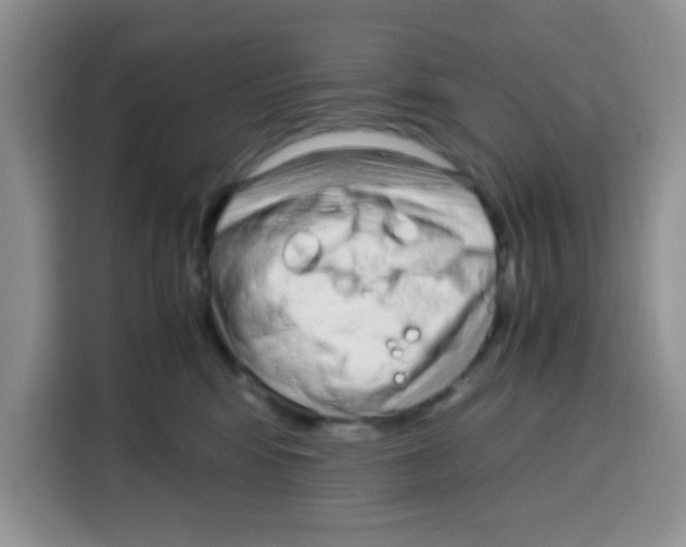 X0000115140424200911241509