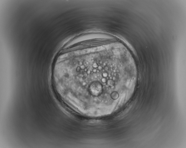 X0000115140437200911241509