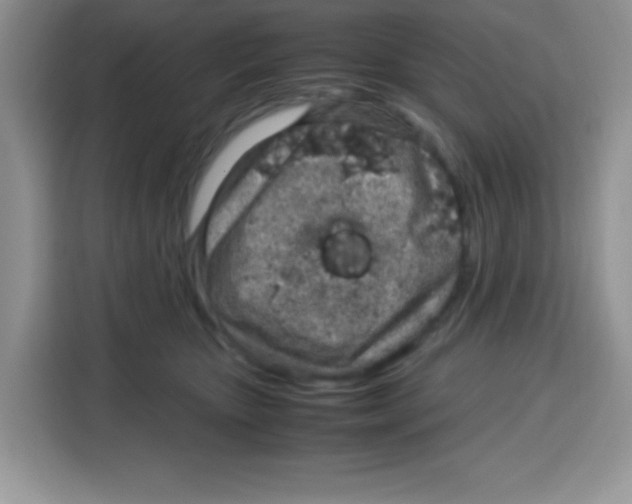 X0000115140467200911241509