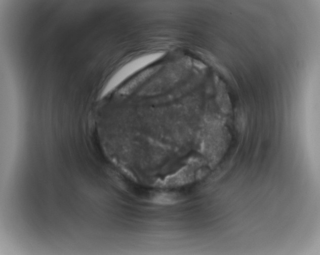X0000115140471200911241509
