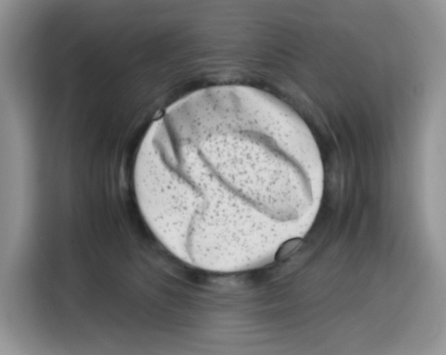 X0000115140516200911241508