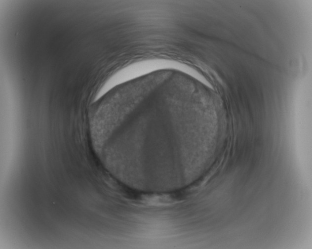 X0000115140517200911241508