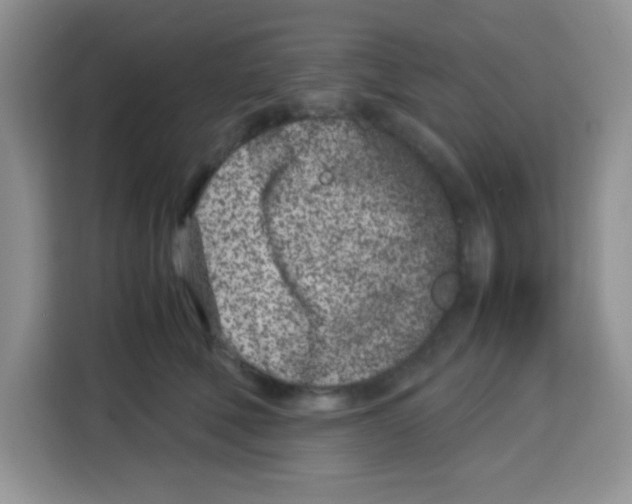 X0000115140610200911241507