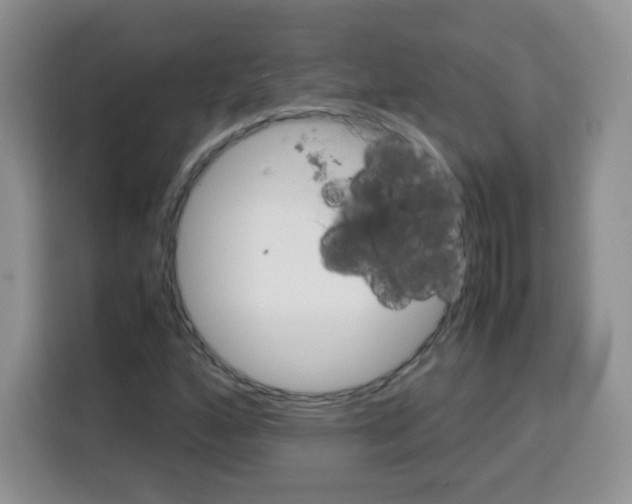X0000115141160200911241500