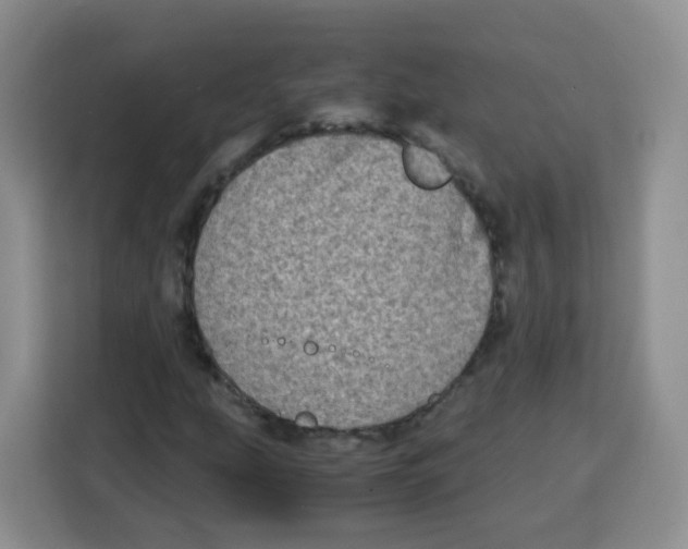 X0000115141207200911241459