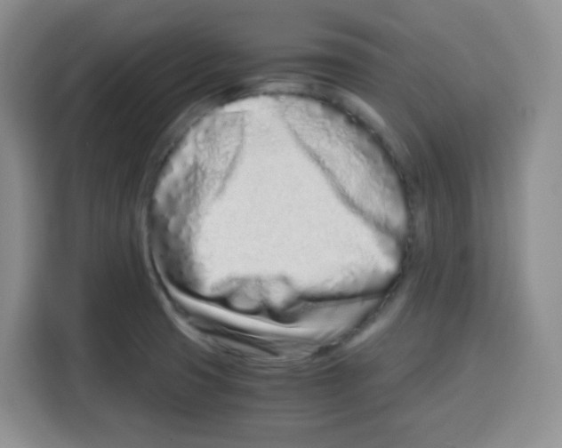 X0000115141425200911241457