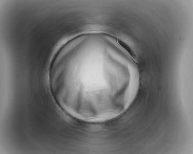 X0000115141472200911241456