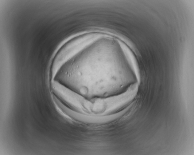 X0000115141535200911241456