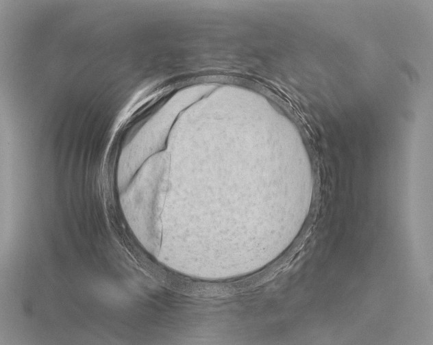 X0000115140198200912081332