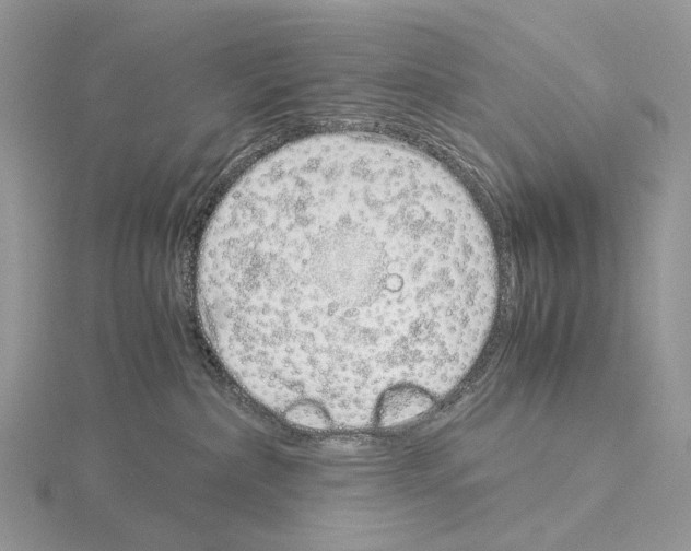 X0000115140236200912081332