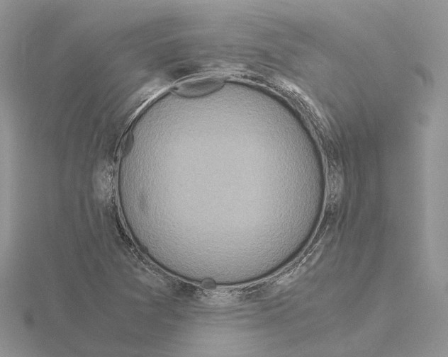 X0000115141361200912081317