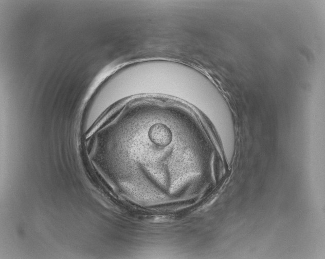 X0000115150056200911171249