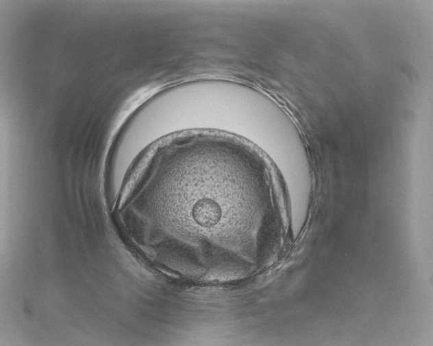 X0000115150104200911171249