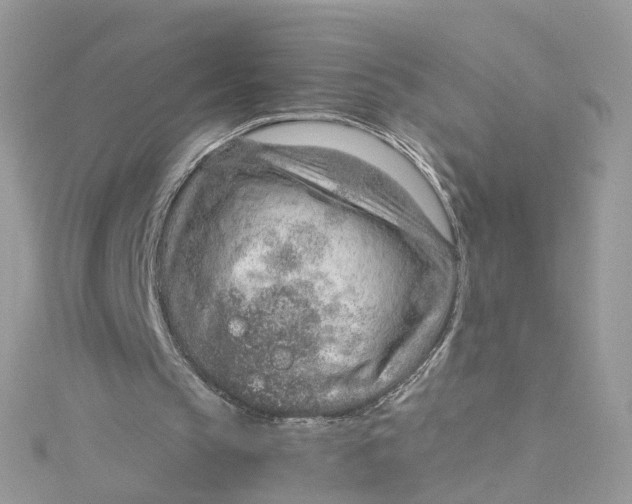 X0000115150145200911171248