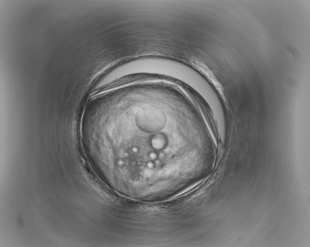 X0000115150249200911171246