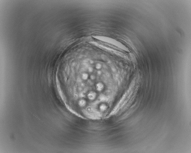 X0000115150285200911171247