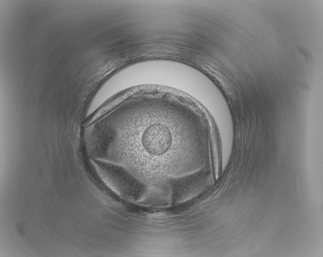 X0000115150309200911171246