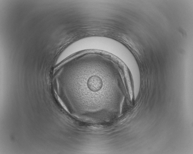 X0000115150317200911171246