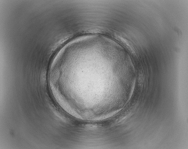 X0000115150394200911171245