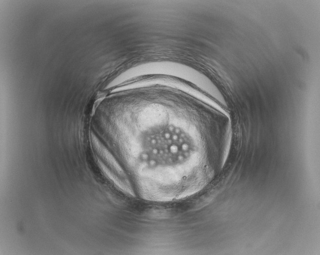 X0000115150416200911171245