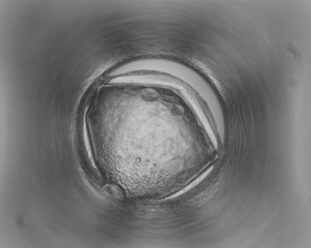 X0000115150443200911171244