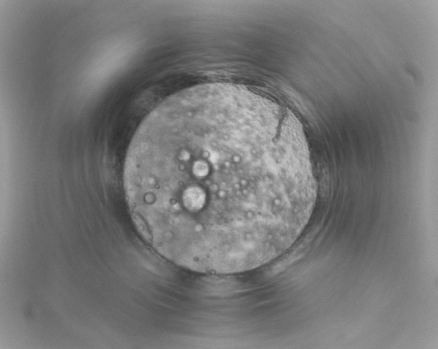 X0000115150477200911171244