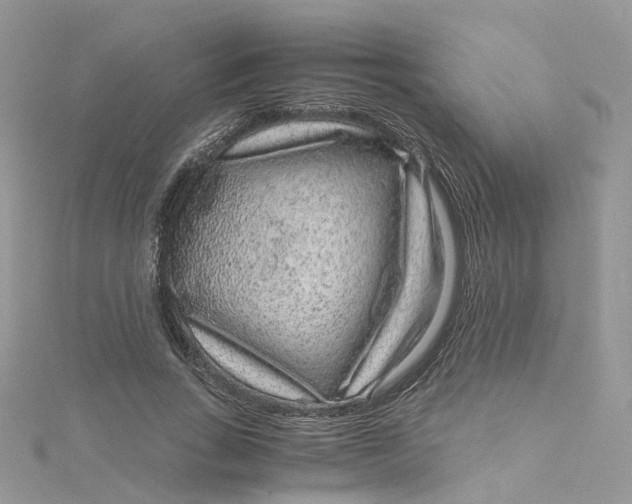 X0000115150735200911171240