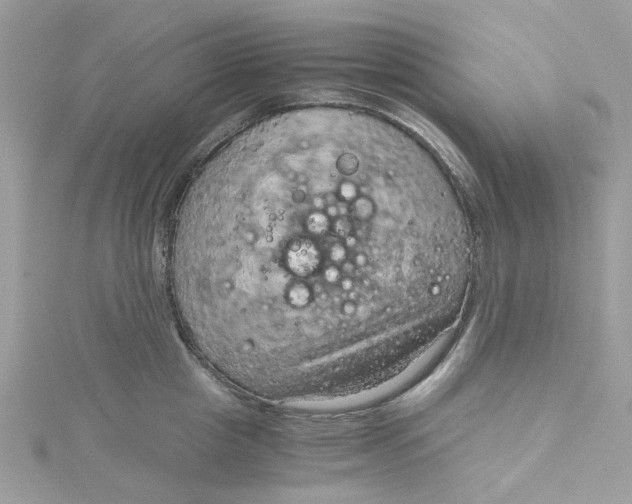 X0000115150857200911171239