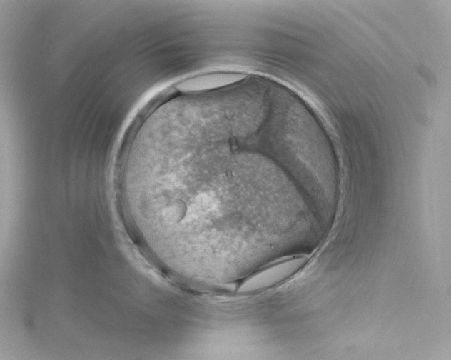 X0000115150864200911171239