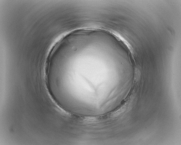 X0000115151477200911171230