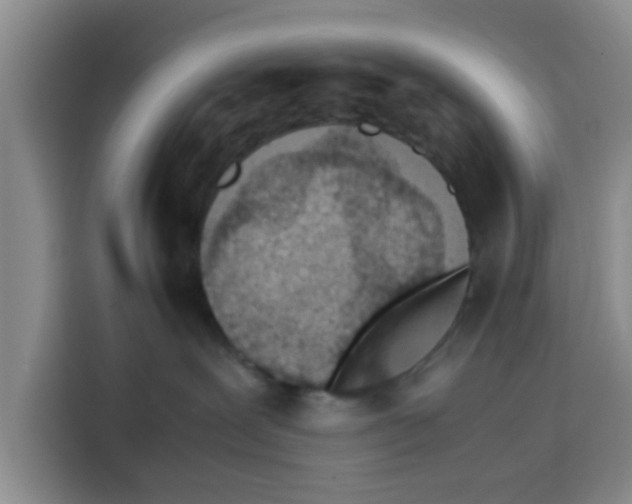 X0000115150239200911241535