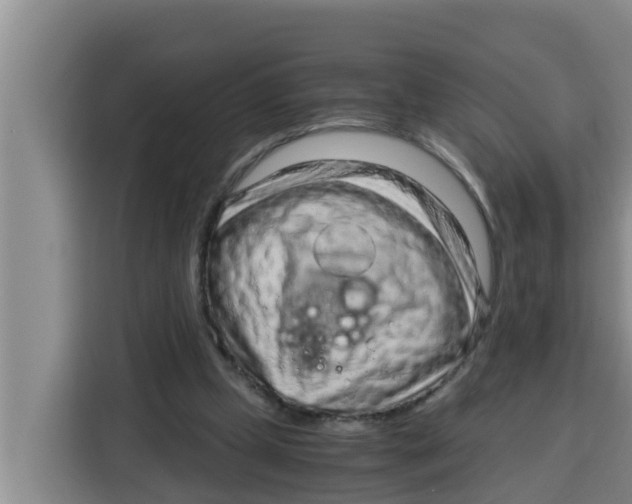 X0000115150249200911241534