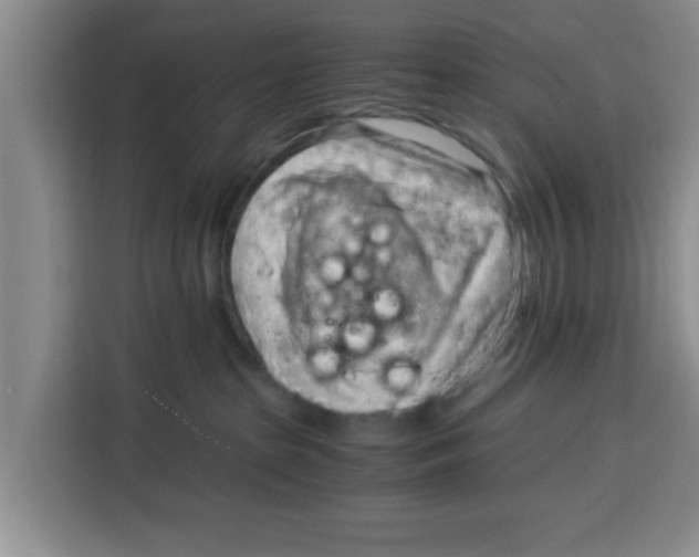 X0000115150285200911241535