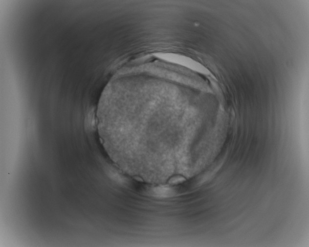 X0000115150383200911241534