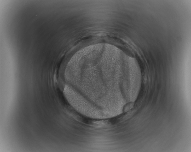 X0000115150516200911241531