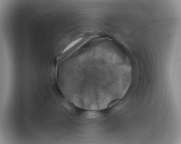 X0000115150528200911241531