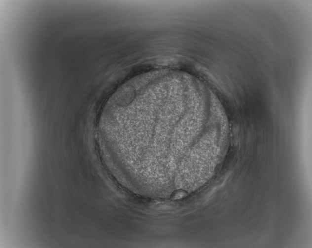 X0000115150913200911241525