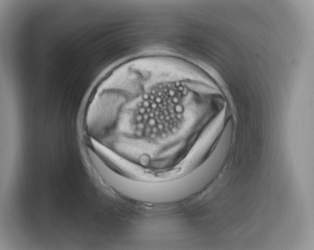 X0000115151008200911241525