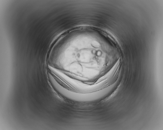 X0000115151129200911241523