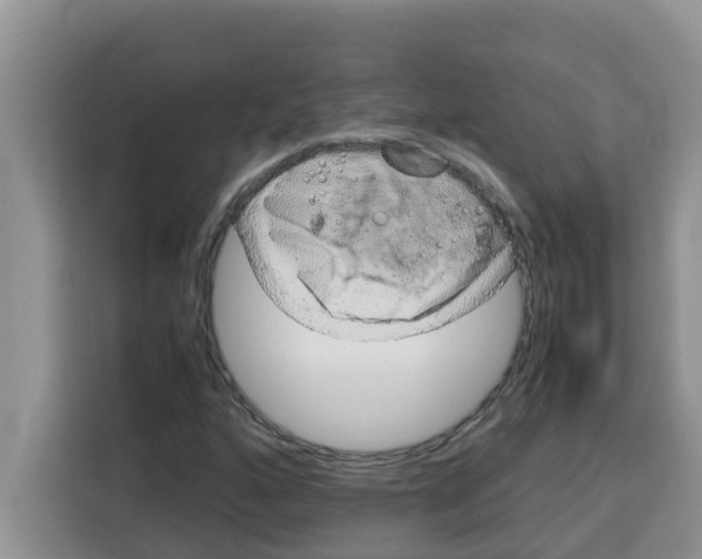 X0000115151160200911241523