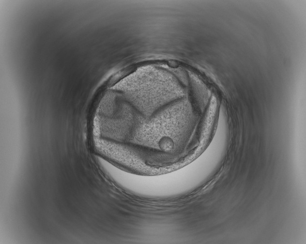 X0000115151165200911241523