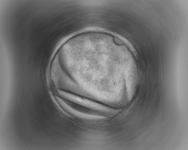 X0000115151295200911241521