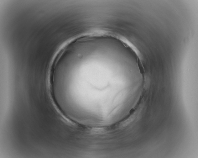 X0000115151477200911241519