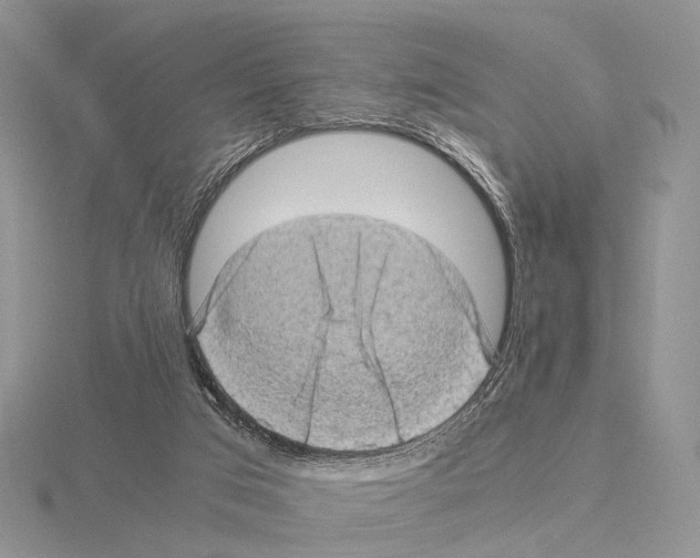 X0000115150017200912081356