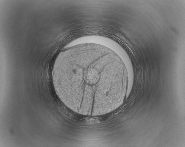 X0000115150520200912081349