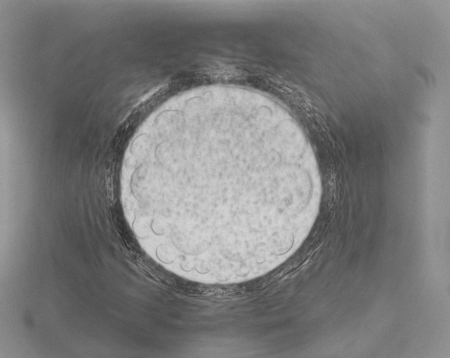 X0000115151205200912081339