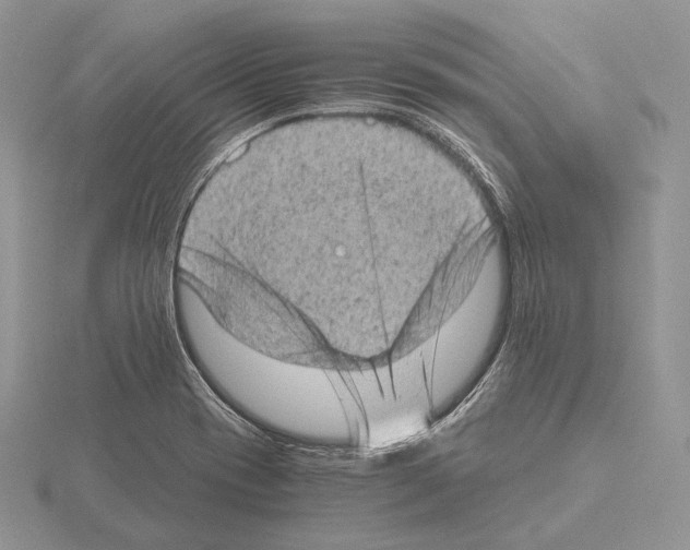 X0000115151417200912081337