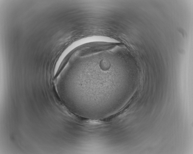 X0000115160528200911101753