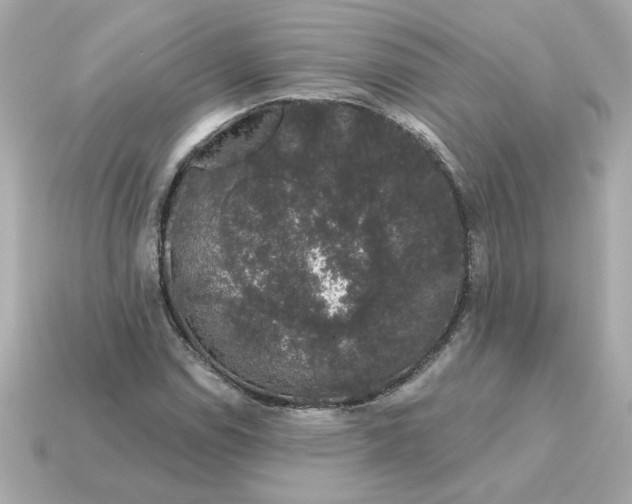 X0000115161114200911101744